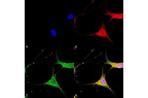 Immunocytochemistry/Immunofluorescence analysis using Mouse Anti-Kir6. (KCNJ8 antibody  (AA 306-424) (PE))