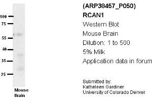 Image no. 2 for anti-Regulator of Calcineurin 1 (RCAN1) (Middle Region) antibody (ABIN405160) (RCAN1 antibody  (Middle Region))