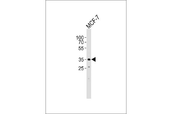 FBXL17 antibody  (C-Term, Isoform 2)