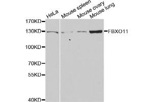 Western blot analysis of extracts of various cell lines, using FBXO11 antibody (ABIN5973628) at 1/1000 dilution. (FBXO11 antibody)