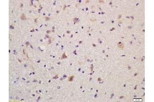 Formalin-fixed and paraffin embedded mouse brain labeled with Anti-GLUR2 Polyclonal Antibody, Unconjugated (ABIN734588) at 1:200, followed by conjugation to the secondary antibody and DAB staining (GRIA2 antibody  (AA 151-250))