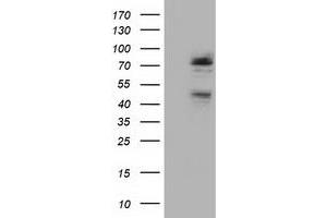 Western Blotting (WB) image for anti-NIMA (Never In Mitosis Gene A)-Related Kinase 11 (NEK11) antibody (ABIN1499683) (NEK11 antibody)