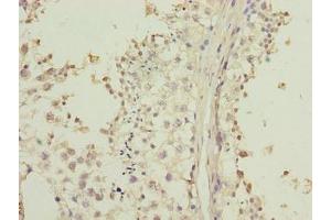 Immunohistochemistry of paraffin-embedded human testis tissue using ABIN7158154 at dilution of 1:100 (LRRC2 antibody  (AA 1-184))