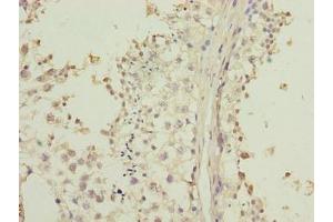 Immunohistochemistry of paraffin-embedded human testis tissue using ABIN7158154 at dilution of 1:100 (LRRC2 antibody  (AA 1-184))