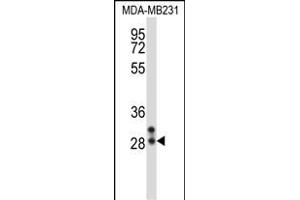 NEUROG2 Antibody (Center) (ABIN657940 and ABIN2846883) western blot analysis in MDA-M cell line lysates (35 μg/lane). (Neurogenin 2 antibody  (AA 95-124))