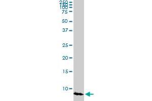 ATOX1 monoclonal antibody (M03), clone 3D10. (ATOX1 antibody  (AA 1-68))