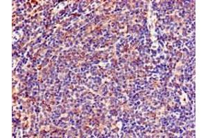 Immunohistochemistry of paraffin-embedded human lymph node tissue using ABIN7151053 at dilution of 1:100 (LNX1 antibody  (AA 133-259))