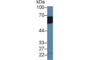 Western Blot; Sample: Mouse Serum; Primary Ab: 2µg/ml Rabbit Anti-Mouse IL18RAP Antibody Second Ab: 0. (IL18RAP antibody  (AA 396-548))