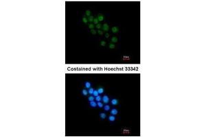 ICC/IF Image Immunofluorescence analysis of paraformaldehyde-fixed HepG2, using FOXB1, antibody at 1:200 dilution. (FOXB1 antibody  (C-Term))