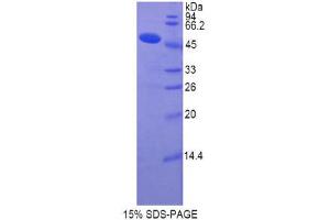SDS-PAGE (SDS) image for Collagen, Type XIV, alpha 1 (COL14A1) (AA 1280-1461) protein (His tag,GST tag) (ABIN2122666)