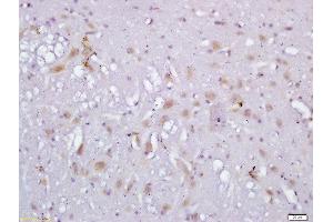 Formalin-fixed and paraffin embedded rat brain labeled with Anti-RLBP1L1 Polyclonal Antibody, Unconjugated  followed by conjugation to the secondary antibody and DAB staining (Clavesin 1 antibody  (AA 231-330))