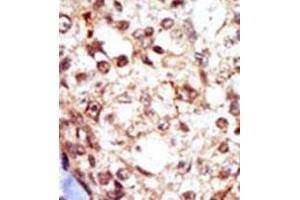 Image no. 2 for anti-Gardner-Rasheed Feline Sarcoma Viral (V-Fgr) Oncogene Homolog (FGR) (AA 11-40), (N-Term) antibody (ABIN359981) (Fgr antibody  (N-Term))