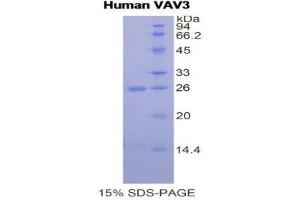 SDS-PAGE (SDS) image for Vav 3 Oncogene (VAV3) (AA 398-583) protein (His tag) (ABIN1878154) (VAV3 Protein (AA 398-583) (His tag))