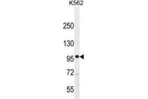 Western blot analysis in K562 cell line lysates (35ug/lane) using MLCK Antibody . (MYLK antibody  (Middle Region))