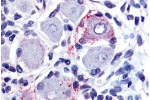 Human Spinal Cord, Dorsal Root Ganglion (formalin-fixed, paraffin-embedded) stained with GPR149 antibody ABIN213495 at 20 ug/ml followed by biotinylated goat anti-rabbit IgG secondary antibody ABIN481713, alkaline phosphatase-streptavidin and chromogen. (GPR149 antibody  (Cytoplasmic Domain))