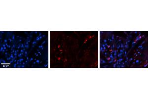 Rabbit Anti-SELENBP1 Antibody     Formalin Fixed Paraffin Embedded Tissue: Human Lung Tissue  Observed Staining: Cytoplasmic, membrane and nuclear in alveolar type I & II cells  Primary Antibody Concentration: 1:100  Other Working Concentrations: 1/600  Secondary Antibody: Donkey anti-Rabbit-Cy3  Secondary Antibody Concentration: 1:200  Magnification: 20X  Exposure Time: 0. (SELENBP1 antibody  (C-Term))