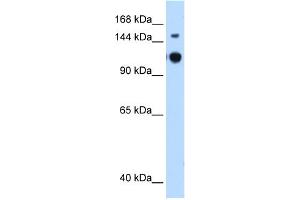 WB Suggested Anti-GAPVD1 Antibody Titration:  0. (GAPVD1 antibody  (N-Term))