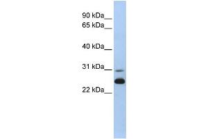 WB Suggested Anti-AK1 Antibody Titration:  0. (Adenylate Kinase 1 antibody  (N-Term))