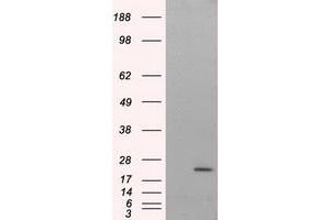 Western Blotting (WB) image for anti-Nitrilase Family, Member 2 (NIT2) antibody (ABIN1499739)