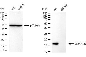 Western blotting analysis using CDKN2C antibody (ABIN7798229). (Recombinant CDKN2C antibody)