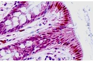 Human, Small intestine: Formalin-Fixed Paraffin-Embedded (FFPE) (HEXIM1 antibody  (AA 181-230))