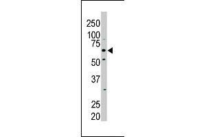 The anti-PKLR Pab (ABIN391050 and ABIN2841209) is used in Western blot to detect PKLR in NIH/3T3 cell lysate. (PKLR antibody  (N-Term))