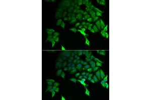 Immunofluorescence analysis of U2OS cells using TSC22D3 antibody (ABIN5974107).