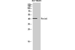 Western Blotting (WB) image for anti-Hexamethylene Bis-Acetamide Inducible 1 (HEXIM1) antibody (ABIN5958804) (HEXIM1 antibody)