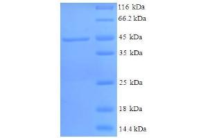 SDS-PAGE (SDS) image for Hydroxysteroid (11-Beta) Dehydrogenase 1 (HSD11B1) (AA 25-292) protein (His-SUMO Tag) (ABIN5709687) (HSD11B1 Protein (AA 25-292) (His-SUMO Tag))