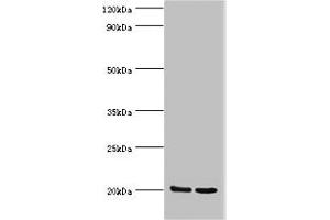 Western blot All lanes: GLO1 antibody at 2 μg/mL Lane 1: HepG2 whole cell lysate Lane 2: Hela whole cell lysate Secondary Goat polyclonal to rabbit IgG at 1/10000 dilution Predicted band size: 21, 20 kDa Observed band size: 21 kDa (GLO1 antibody  (AA 1-184))