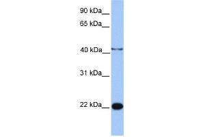 WB Suggested Anti-C2orf68 Antibody Titration: 0. (C2orf68 antibody  (N-Term))