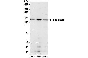 Western Blotting (WB) image for anti-TBC1 Domain Family, Member 9B (With GRAM Domain) (TBC1D9B) (AA 1200-1250) antibody (ABIN7450808)