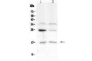 Western blot analysis of IL1F10 using anti-IL1F10 antibody . (IL1F10 antibody  (AA 1-152))