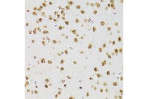 Immunohistochemistry of paraffin-embedded mouse brain using CSRP3 Antibody (ABIN2562048) at dilution of 1:100 (40x lens). (CSRP3 antibody)