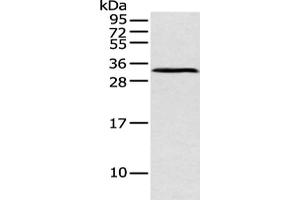 Gel: 12 % SDS-PAGE, Lysate: 40 μg, Lane: Mouse pancreas tissue, Primary antibody: ABIN7128589(ATP4B Antibody) at dilution 1/250 dilution, Secondary antibody: Goat anti rabbit IgG at 1/8000 dilution, Exposure time: 1 minute (ATP4b antibody)