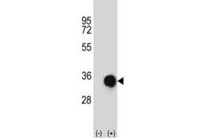 Western blot analysis of Caspase-6 antibody and 293 cell lysate (2 ug/lane) either nontransfected (Lane 1) or transiently transfected (2) with the CASP6 gene.