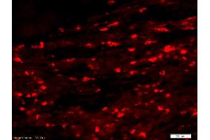 Immunofluorescence (IF) image for anti-Interferon Regulatory Factor 3 (IRF3) (pSer396) antibody (ABIN742688)