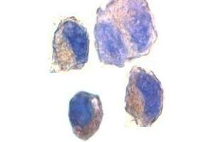 Immunocytochemical staining of K562 cells with ADAM10 antibody at 2ug/ml. (ADAM10 antibody)