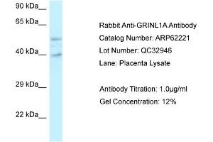 Western Blotting (WB) image for anti-Glutamate Receptor, Ionotropic, N-Methyl D-Aspartate-Like 1A (GRINL1A) (C-Term) antibody (ABIN2789069) (POLR2M antibody  (C-Term))