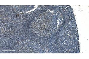 IHC analysis of TIMM8A/DDP using anti-TIMM8A/DDP antibody (ABIN7600039).