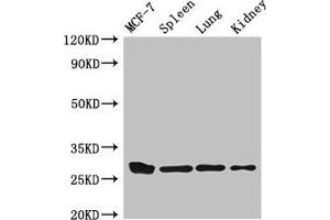Western Blot Positive WB detected in: MCF-7 whole cell lysate, Mouse spleen tissue, Mouse lung tissue, Mouse kidney tissue All lanes: CMA1 antibody at 3 μg/mL Secondary Goat polyclonal to rabbit IgG at 1/50000 dilution Predicted band size: 28, 15 kDa Observed band size: 28 kDa (CMA1 antibody  (AA 22-247))
