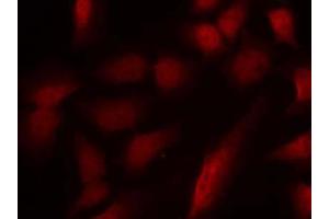 Immunofluorescence staining of methanol-fixed HeLa cells using GATA1 (phospho-Ser310) antibody (E011042, Red) (GATA1 antibody  (pSer310))