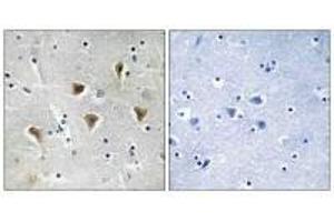 Immunohistochemistry analysis of paraffin-embedded human brain tissue using MTERF antibody. (MTERF antibody)