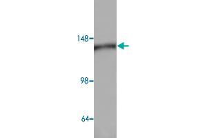 Western blot analysis of HeLa cell lysate with AP3D1 polyclonal antibody  at 1:500 dilution. (AP3D1 antibody)