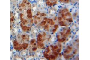 Used in DAB staining on fromalin fixed paraffin-embedded Kidney tissue (BMP6 antibody  (AA 375-513))