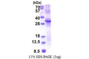 SLAP2 Protein (AA 1-261) (His tag)