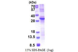 SDS-PAGE (SDS) image for Src-like-adaptor 2 (SLA2) (AA 1-261) protein (His tag) (ABIN5853434)