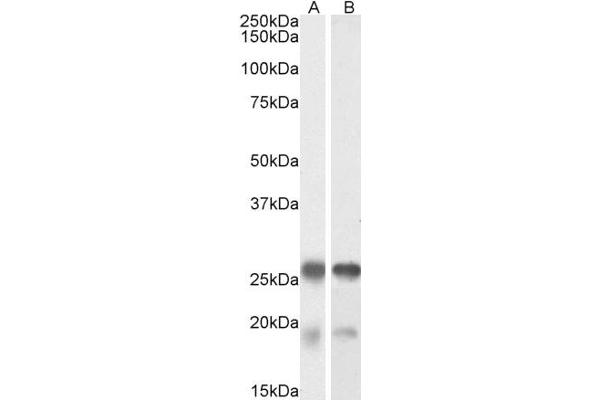 Tppp antibody  (Internal Region)