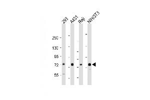 All lanes : Anti-TAK1 (Ser439) Antibody at 1:1000-1:2000 dilution Lane 1: 293 whole cell lysate Lane 2: A431 whole cell lysate Lane 3: Raji whole cell lysate Lane 4: NIH/3T3 whole cell lysate Lysates/proteins at 20 μg per lane. (TR4 antibody  (Ser439))