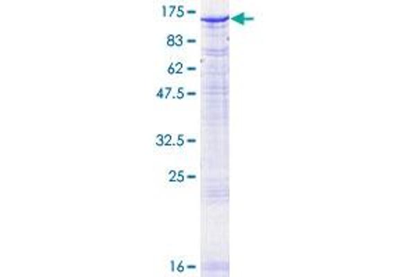 PMS2 Protein (AA 1-862) (GST tag)